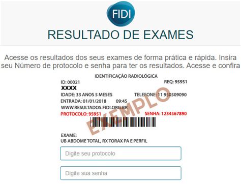 optixone resultado de exames|resultados de exames a.